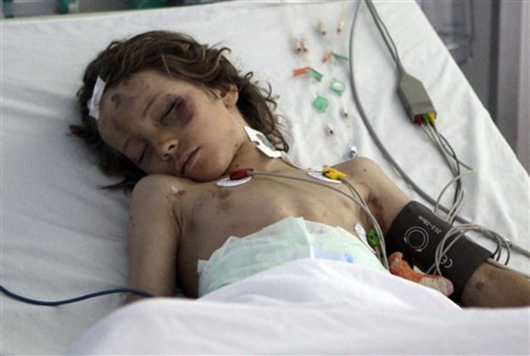9 Year-old Ruben van Assouw in his hospital bed in Tripoli's El Khadra hospital, Libya on Thursday. 